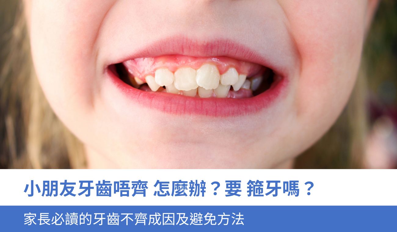 小朋友牙齒唔齊怎麼辦？