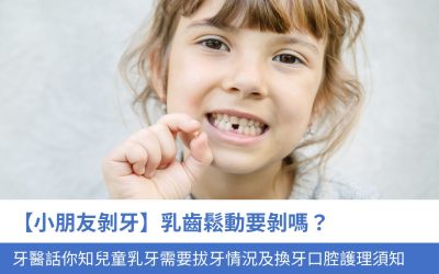 【小朋友剝牙】乳齒鬆動要剝嗎？牙醫 話你知4大 兒童乳牙需要拔牙情況及換牙口腔護理須知