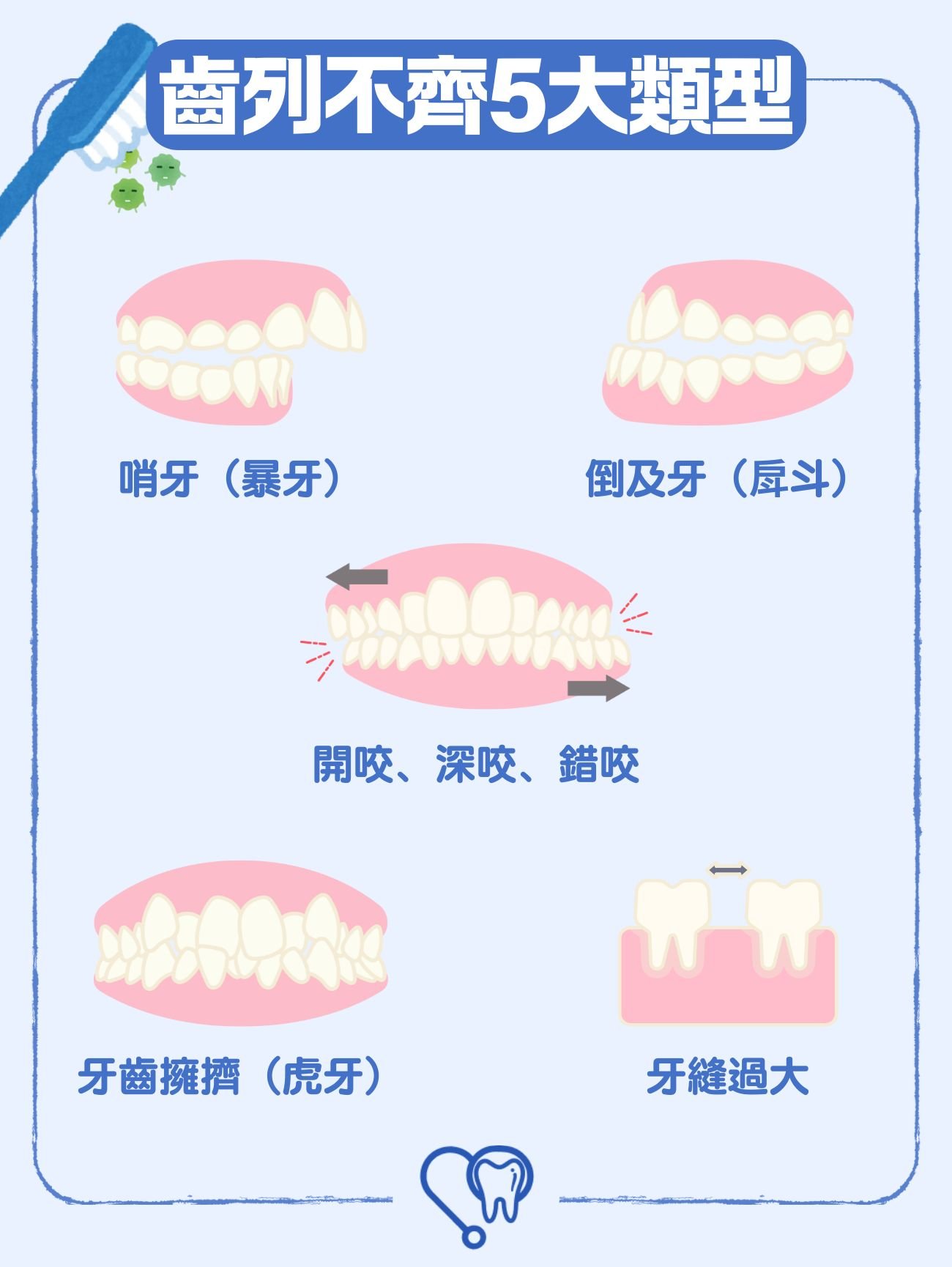 齒列不齊5大類型