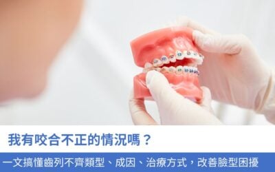 我有咬合不正的情況嗎？一文搞懂齒列不齊5大類型、成因、治療方式，改善牙齒健康及臉型困擾