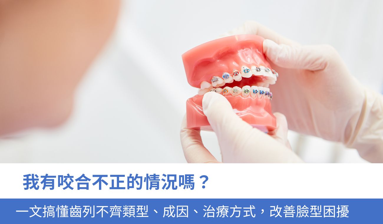怎麼知道自己咬合不正？一文搞懂牙齒不齊5大類型、成因、矯正方式