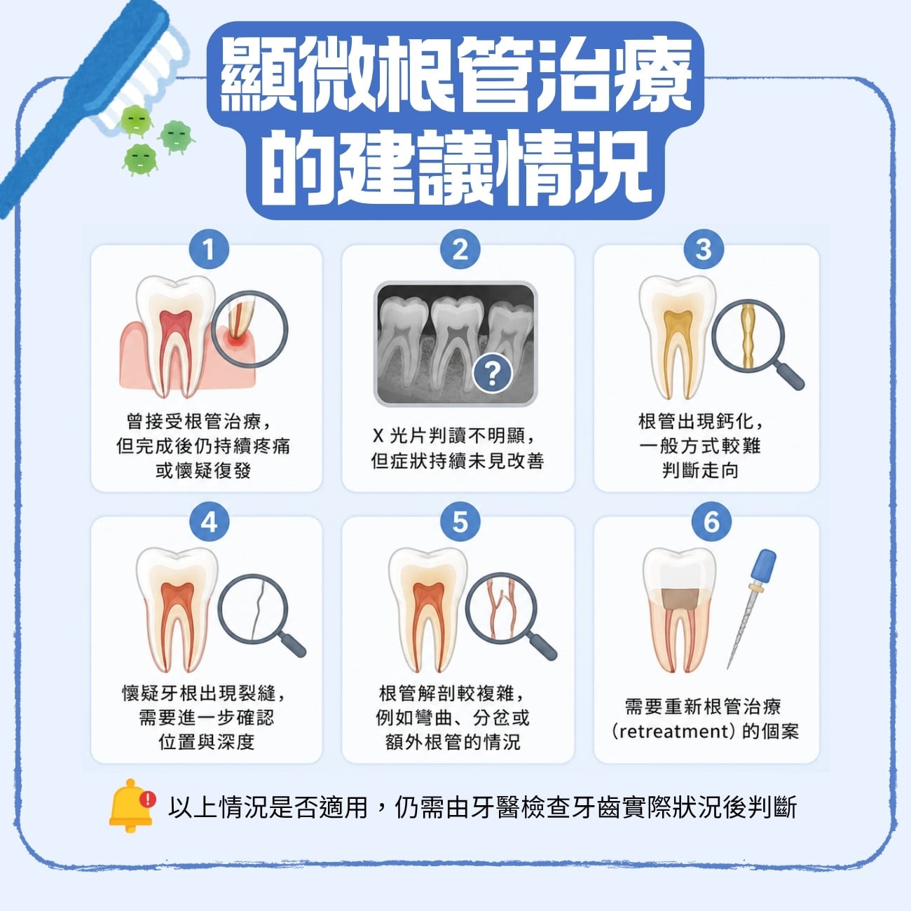 什麼時候需要顯微根管治療?