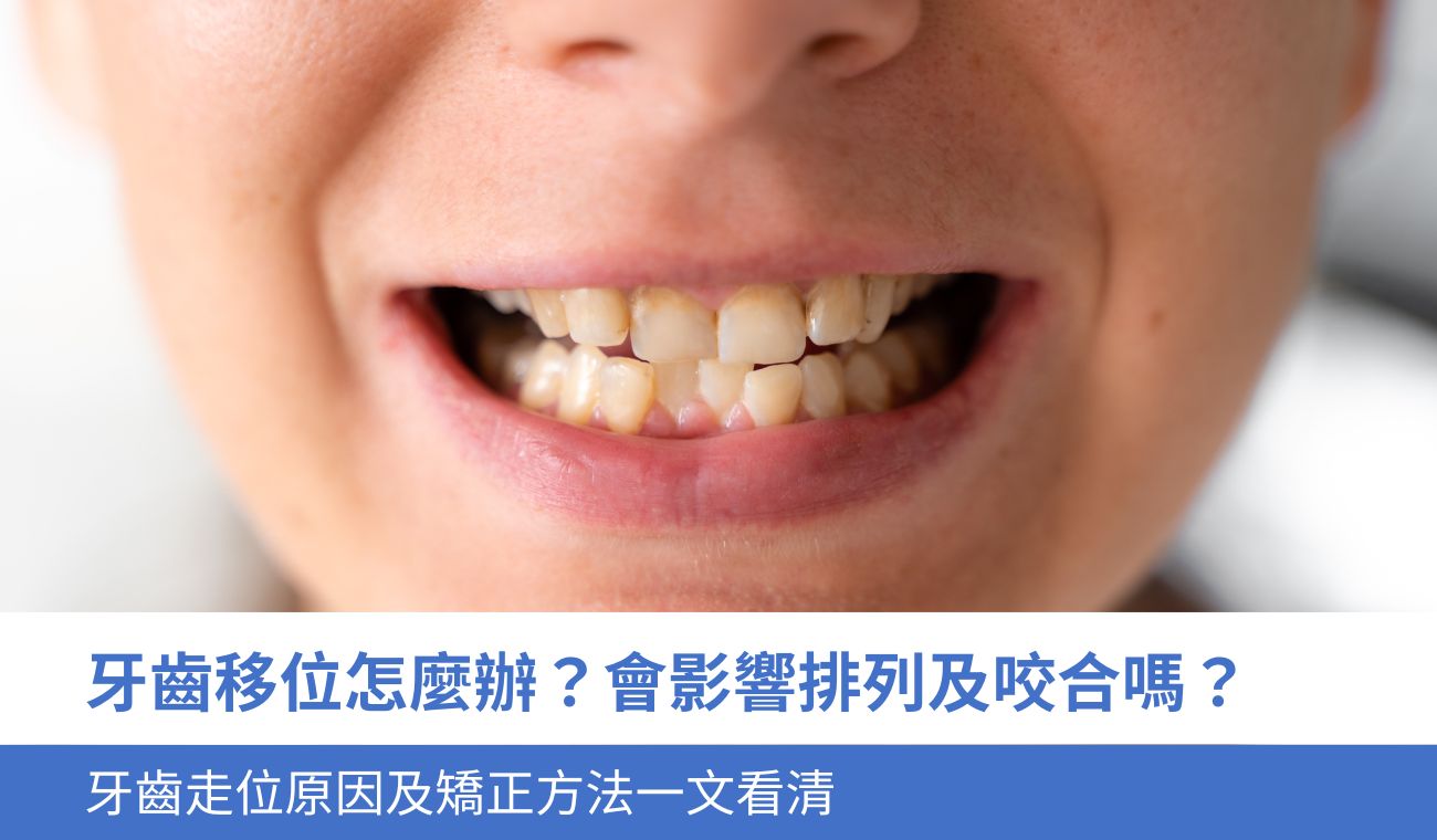 牙齒移位怎麼辦？