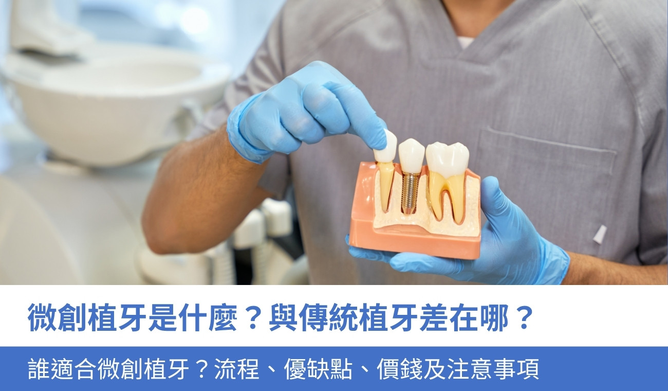 minimally-invasive-dental-implants 微創植牙是什麼?與傳統植牙 差在哪?誰適合微創植牙?4大流程、優缺點、價錢及注意事項