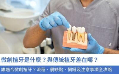 微創植牙是什麼？與傳統植牙 差在哪？誰適合微創植牙？4大流程、優缺點、價錢及注意事項全攻略