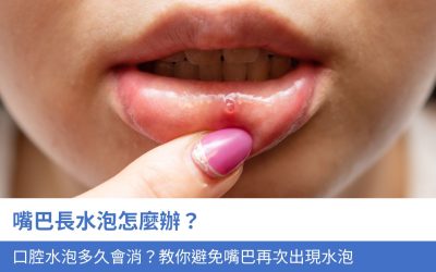 嘴巴長水泡怎麼辦？口腔水泡多久會消？4大要點教你避免嘴巴再次出現水泡