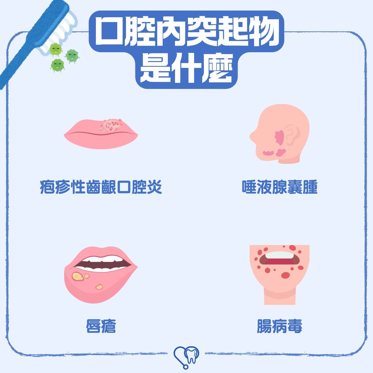 口腔內突起物是什麼