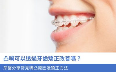 凸嘴可以透過牙齒矯正改善嗎？牙醫分享4個常見 嘴凸原因及矯正方法