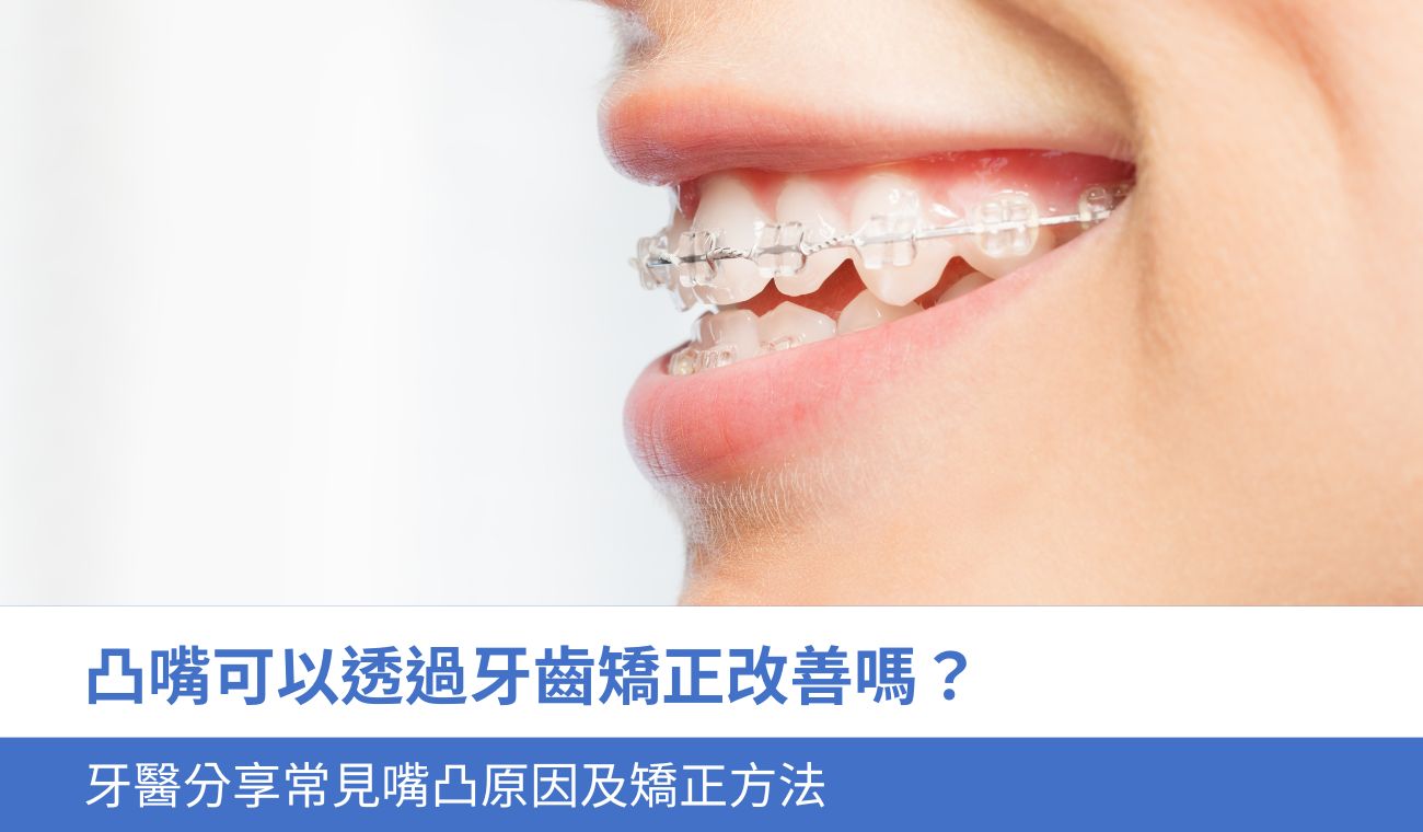 凸嘴可以透過牙齒矯正改善嗎?