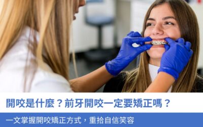 牙科知識庫 6 開咬是什麼?前牙開咬一定要矯正嗎?一文掌握開咬矯正3大方式,重拾自信笑容