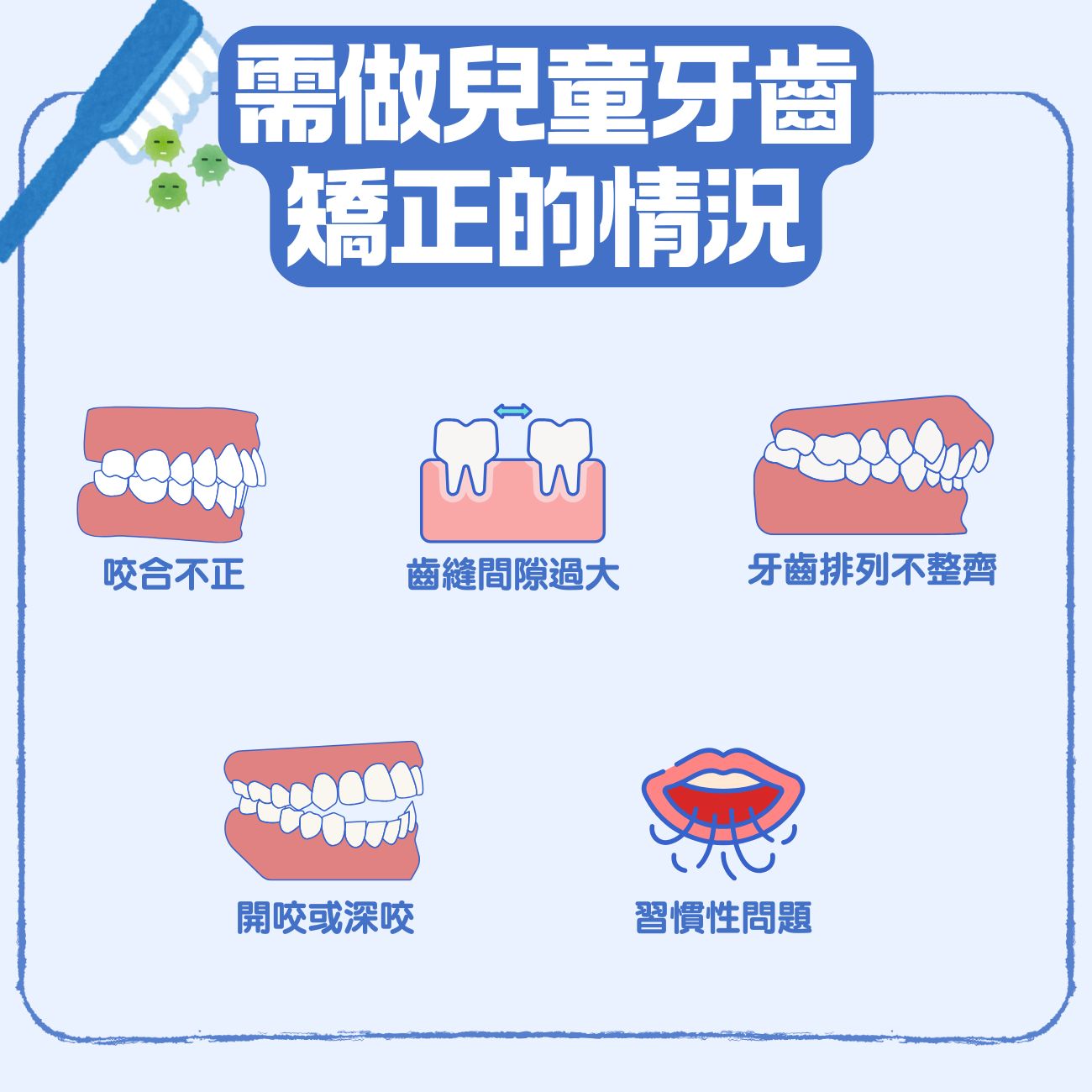 【兒童箍牙】小朋友牙齒不齊幾歲適合矯正?牙醫 話你知5大 箍牙情況及矯齒黃金時期 4 哪些情況需要做兒童牙齒矯正?
