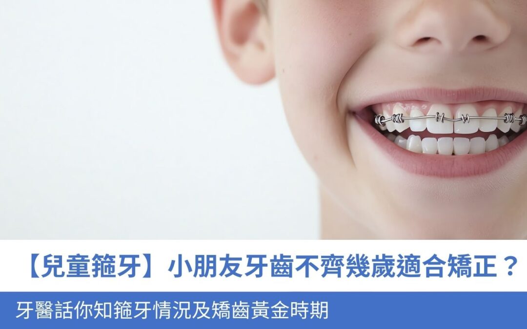 【兒童箍牙】小朋友牙齒不齊幾歲適合矯正？牙醫 話你知5大 箍牙情況及矯齒黃金時期