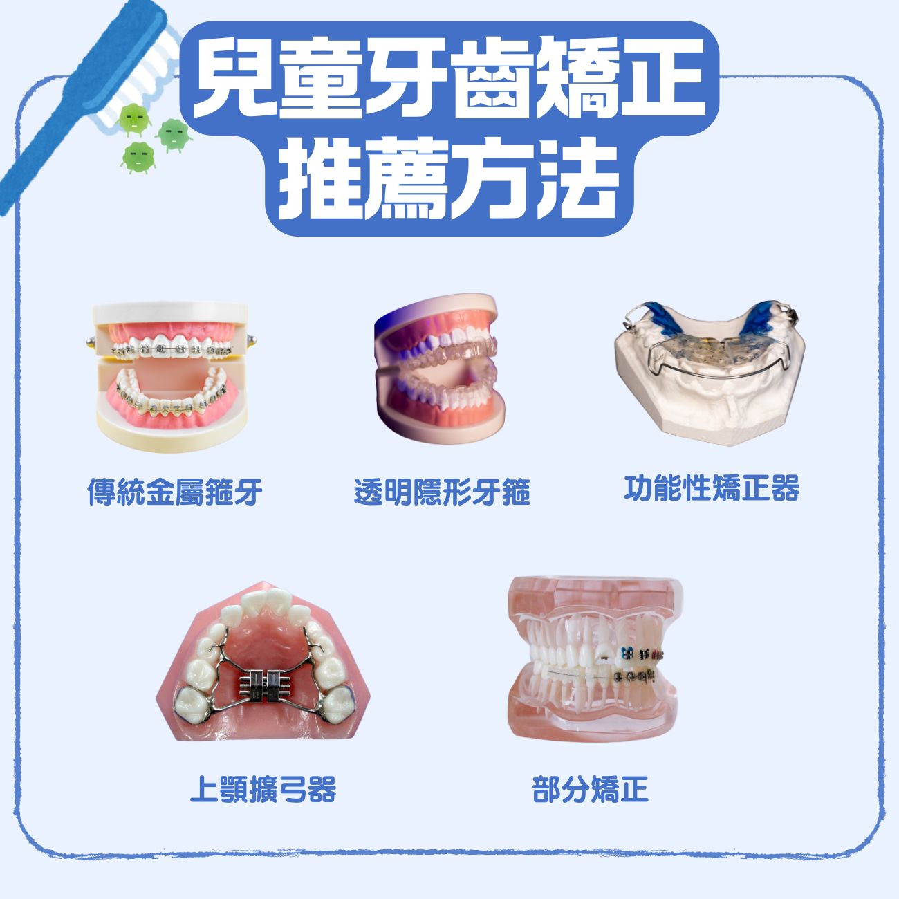 【兒童箍牙】小朋友牙齒不齊幾歲適合矯正?牙醫 話你知5大 箍牙情況及矯齒黃金時期 5 兒童牙齒矯正推薦方法