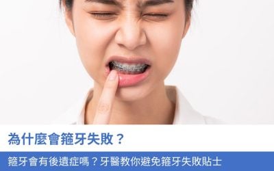 為什麼會箍牙失敗？箍牙會有後遺症嗎？牙醫教你5招避免箍牙失敗貼士
