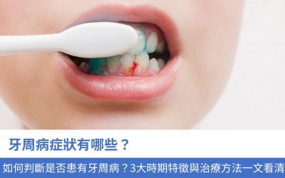 牙周病症狀有哪些？如何判斷自己是否患有牙周病？3大時期特徵與治療方法一文看清