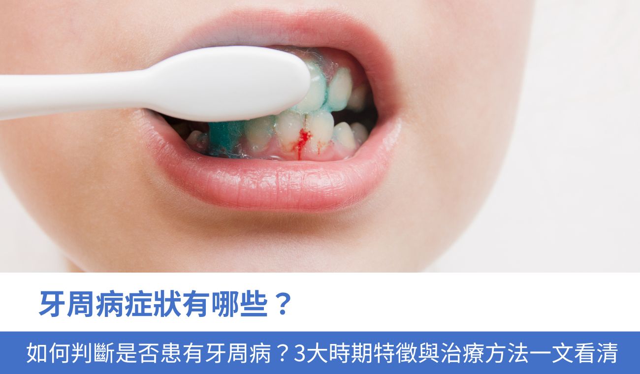 牙周病症狀有哪些？
