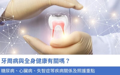 牙周病與全身健康有關嗎?糖尿病、心臟病、失智症 3 種疾病的關係及照護重點