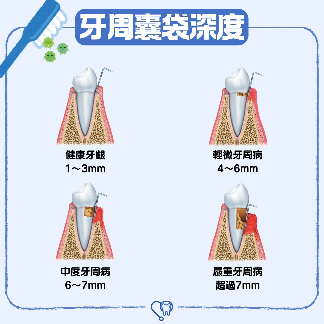 牙周囊袋深度