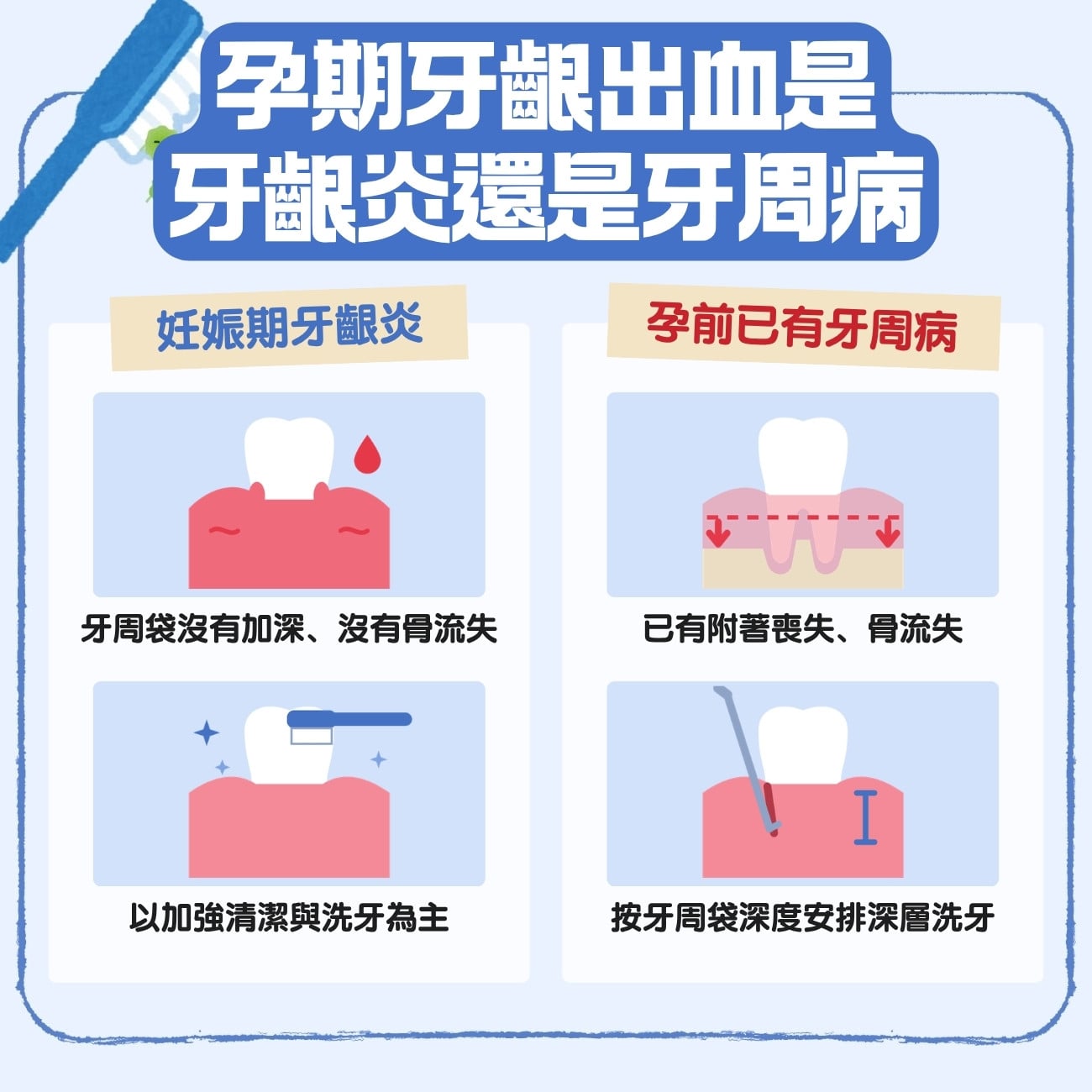 孕期牙齦出血是妊娠期牙齦炎還是牙周病?