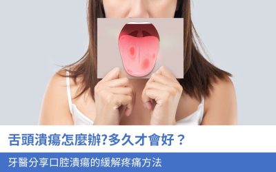 舌頭潰瘍怎麼辦?多久才會好？醫生分享口腔潰瘍的5種緩解疼痛技巧