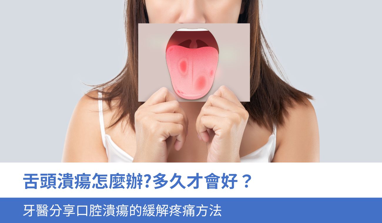 舌頭潰瘍怎麼辦?
