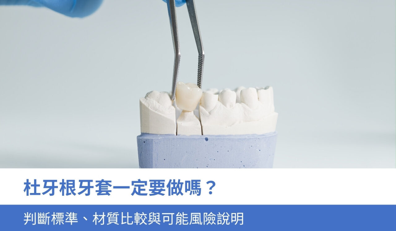 杜牙根牙套一定要做嗎？4大判斷標準與可能風險說明