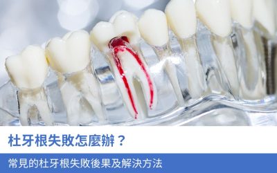 杜牙根失敗怎麼辦？4種最常見的杜牙根失敗後果及解決方法