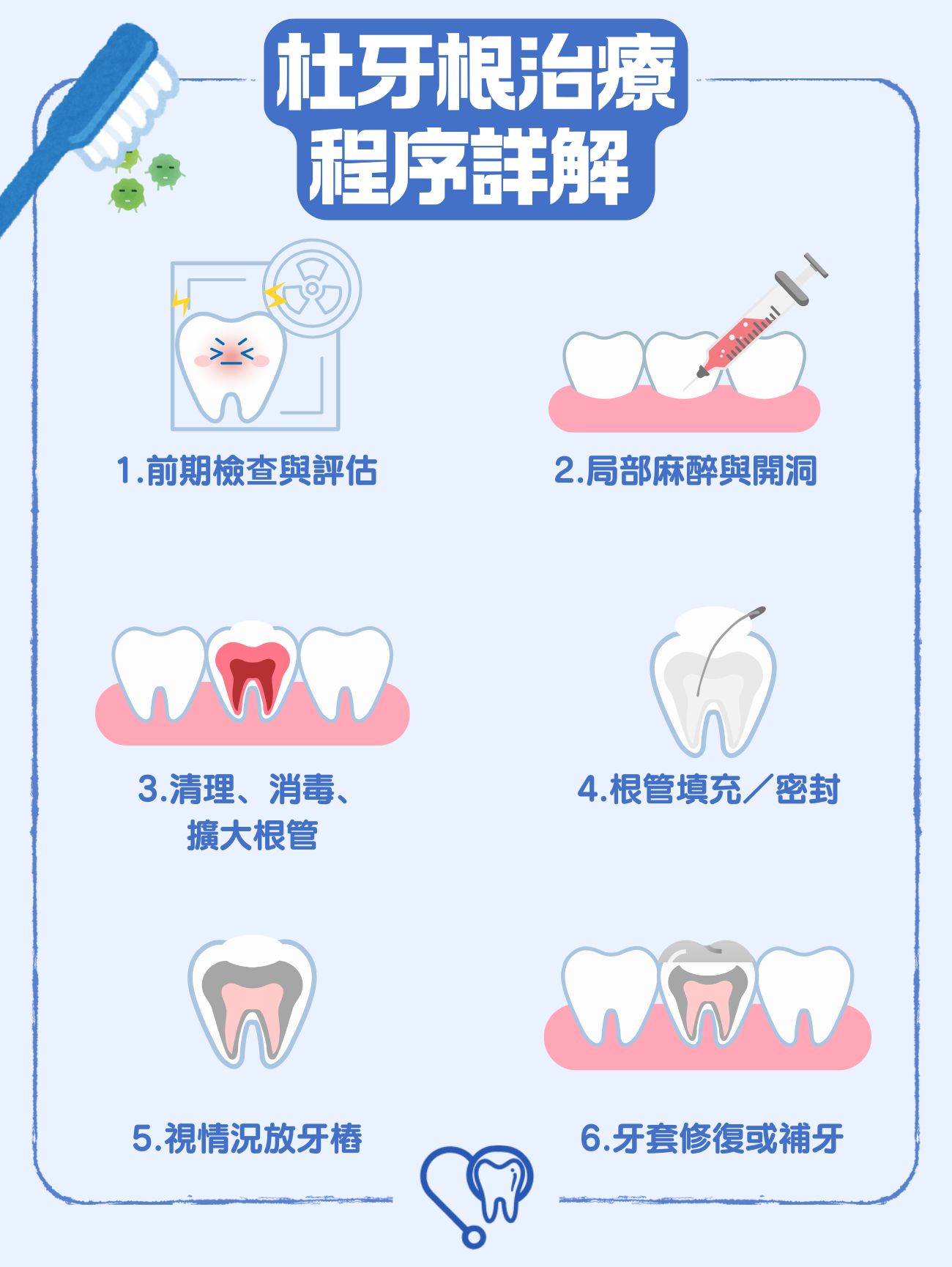 香港杜牙根全攻略:根管治療流程、價錢、風險與護理注意事項一文看清 5 杜牙根治療程序詳解