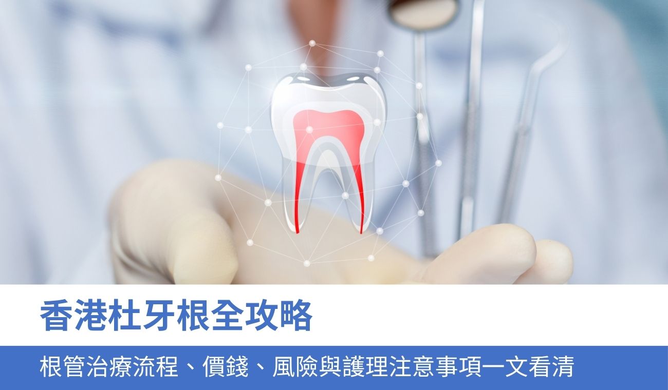 香港杜牙根全攻略:根管治療流程、價錢、風險與護理注意事項一文看清