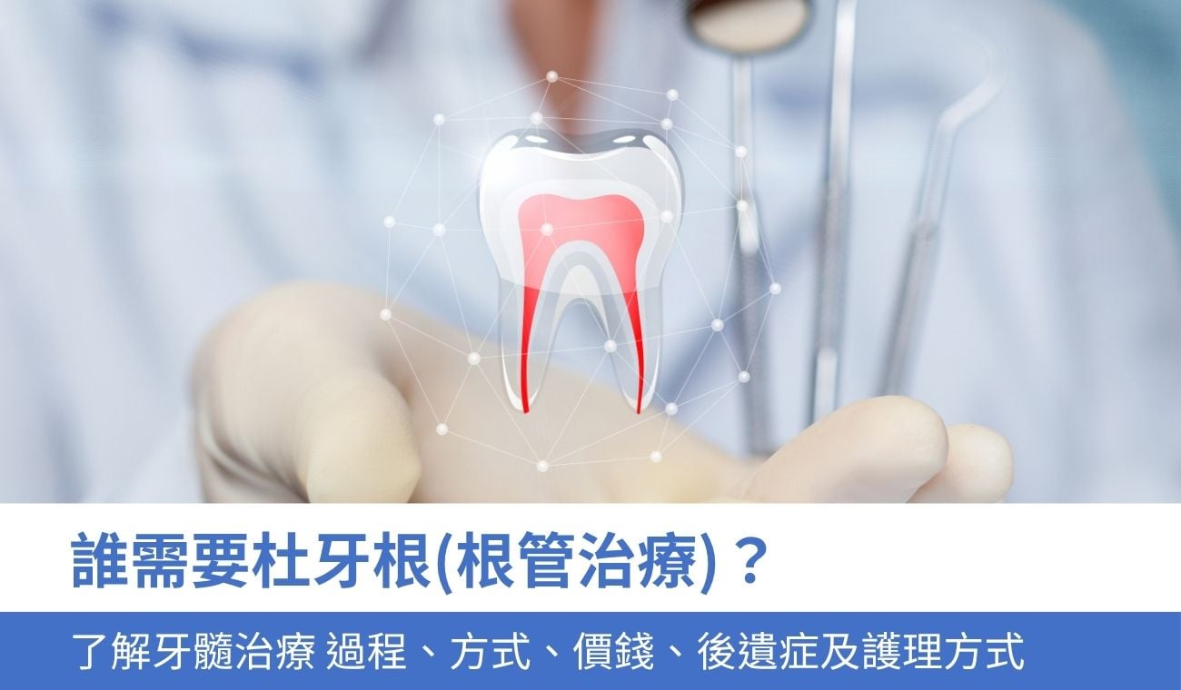 誰需要杜牙根(根管治療)？
