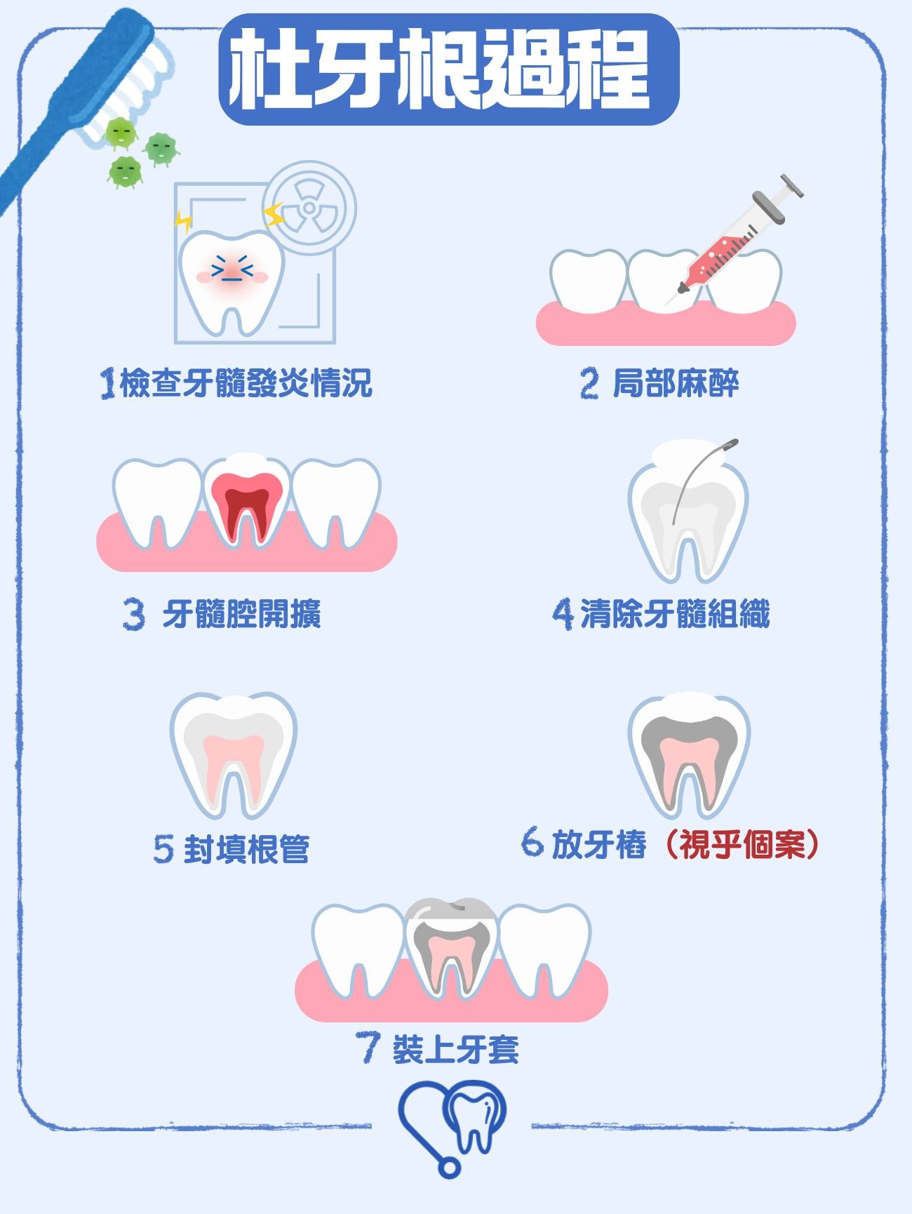 杜牙根過程