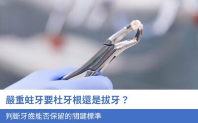 嚴重蛀牙要杜牙根還是拔牙?3個判斷牙齒能否保留的關鍵標準