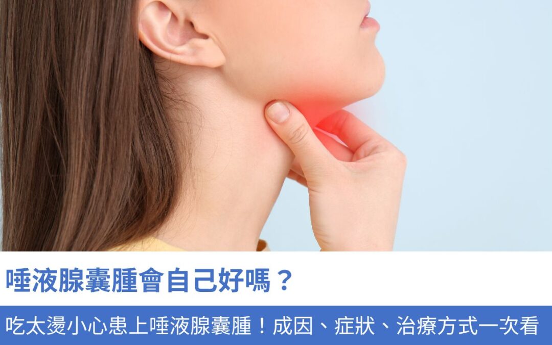 唾液腺囊腫會自己好嗎？吃太快、太燙小心患上唾液腺囊腫！5大成因、症狀、治療方式一文解析