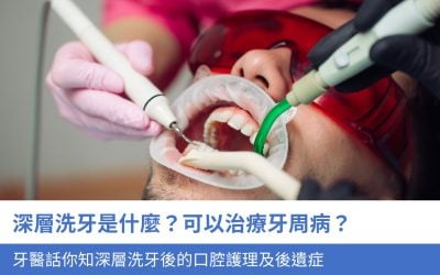 深層洗牙是什麼？可以治療牙周病？牙醫話你知深層洗牙後的口腔護理及5大後遺症