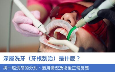 深層洗牙(牙根刮治)是什麼?與一般洗牙的分別、適用情況及術後 3 種正常反應