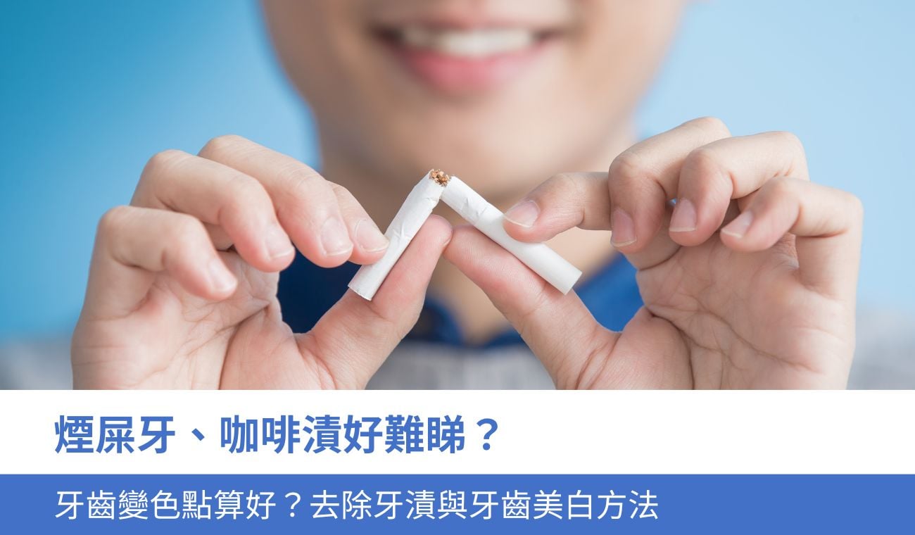 煙屎牙、咖啡漬好難睇？