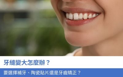 牙縫變大怎麼辦？要選擇補牙、陶瓷貼片還是牙齒矯正？4招治療方法讓牙齒恢復整齊