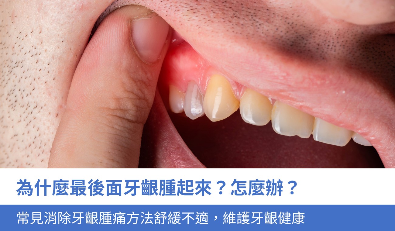 swollen-gums-at-back-mouth 為什麼最後面牙齦腫起來?怎麼辦?3大消除牙齦腫痛方法舒緩不適,維護牙齦健康