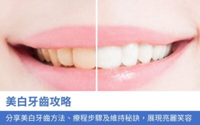 牙科知識庫 8 美白牙齒攻略:牙醫分享3大美白牙齒方法、療程步驟及維持秘訣,展現亮麗笑容