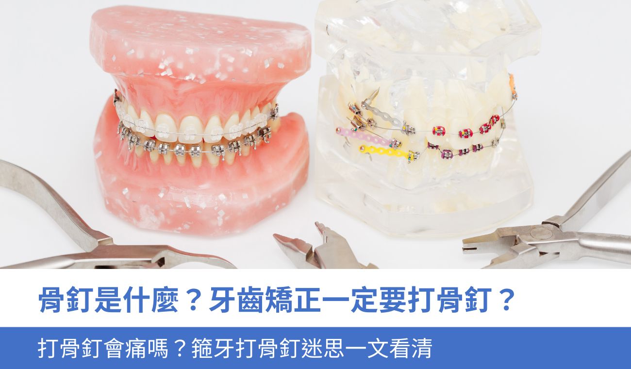 骨釘是什麼？