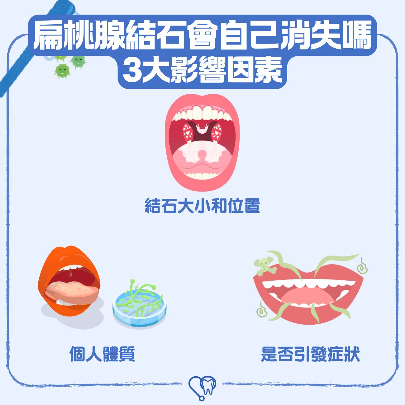 扁桃腺結石會自己消失嗎？