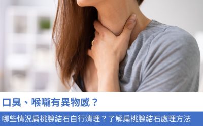 口臭、喉嚨有異物感？哪些情況扁桃腺結石自行清理？3分鐘了解扁桃腺結石處理方法