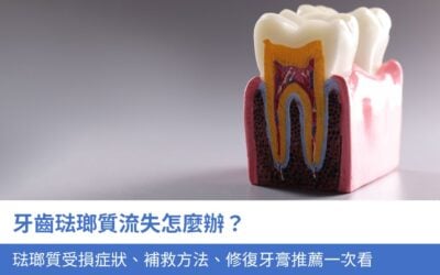 牙齒琺瑯質流失怎麼辦？3大琺瑯質受損症狀、補救方法、修復牙膏推薦一次看