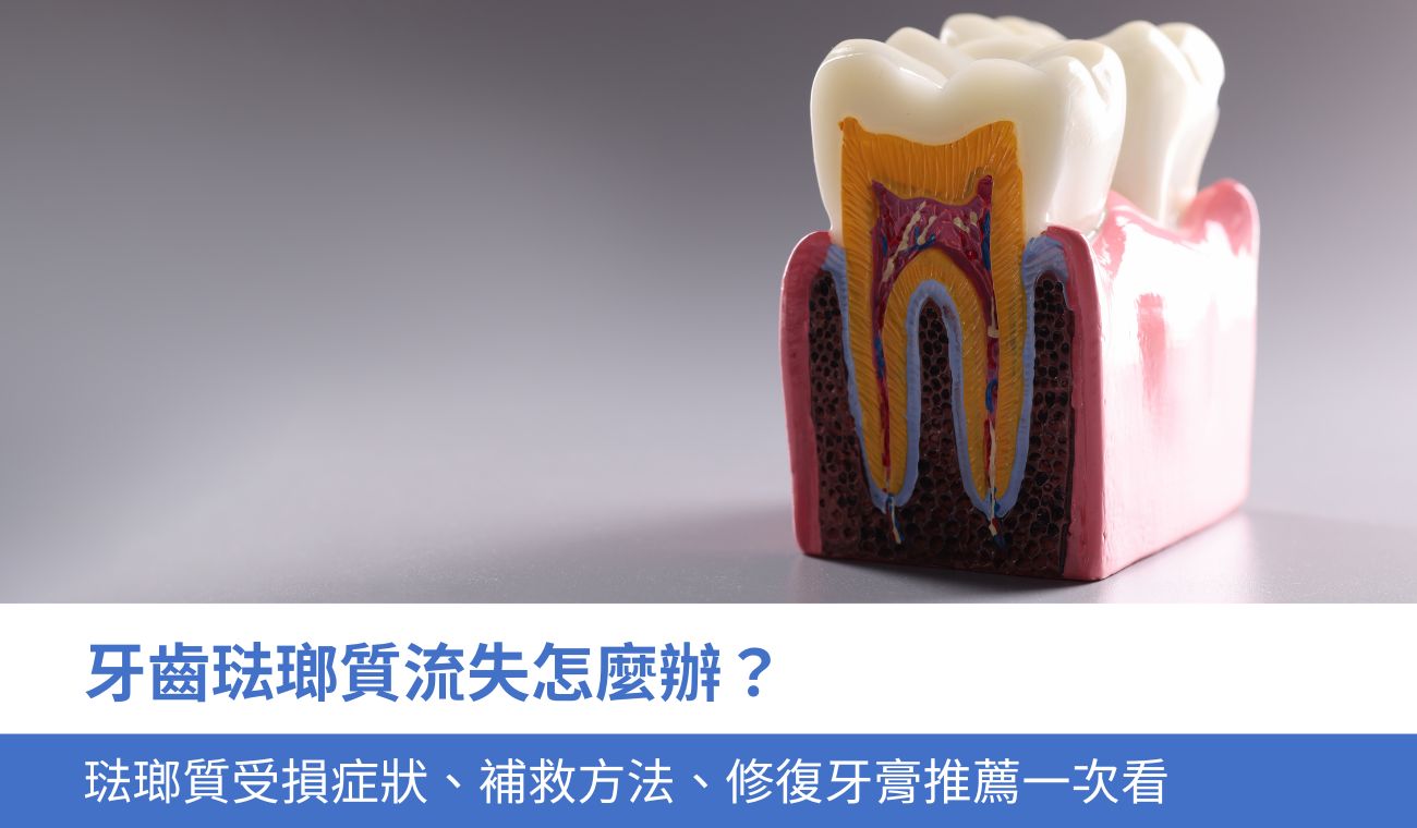 牙齒琺瑯質流失怎麼辦？3大琺瑯質受損症狀、補救方法、修復牙膏推薦一次看
