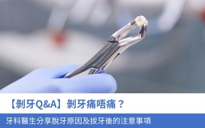 【剝牙Q&A】剝牙痛唔痛？牙科醫生分享5大 脫牙原因及拔牙後的注意事項
