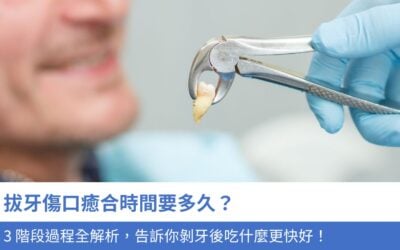 拔牙傷口癒合時間要多久？3 階段過程全解析，告訴你剝牙後吃什麼更快好！