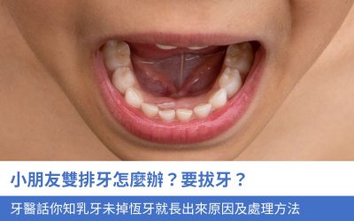 小朋友雙排牙怎麼辦？要拔牙？牙醫 話你知乳牙未脫落 恆牙就長出來的2大原因及處理方法