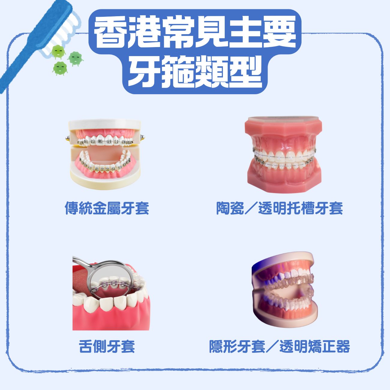 我適合哪一種牙齒矯正方式?4大牙箍類型優缺點、費用、選擇考量一次看 3 香港常見主要牙箍類型