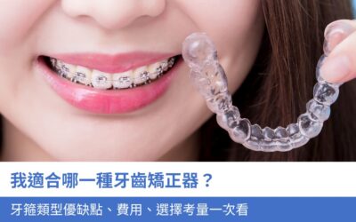 我適合哪一種牙齒矯正方式？4大牙箍類型優缺點、費用、選擇考量一次看