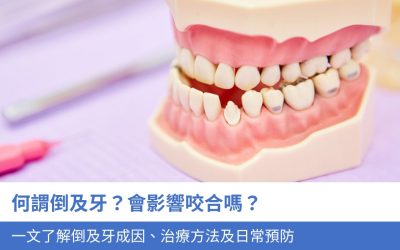何謂倒及牙？會影響咬合嗎？一文了解2大 倒及牙成因、治療方法及日常預防
